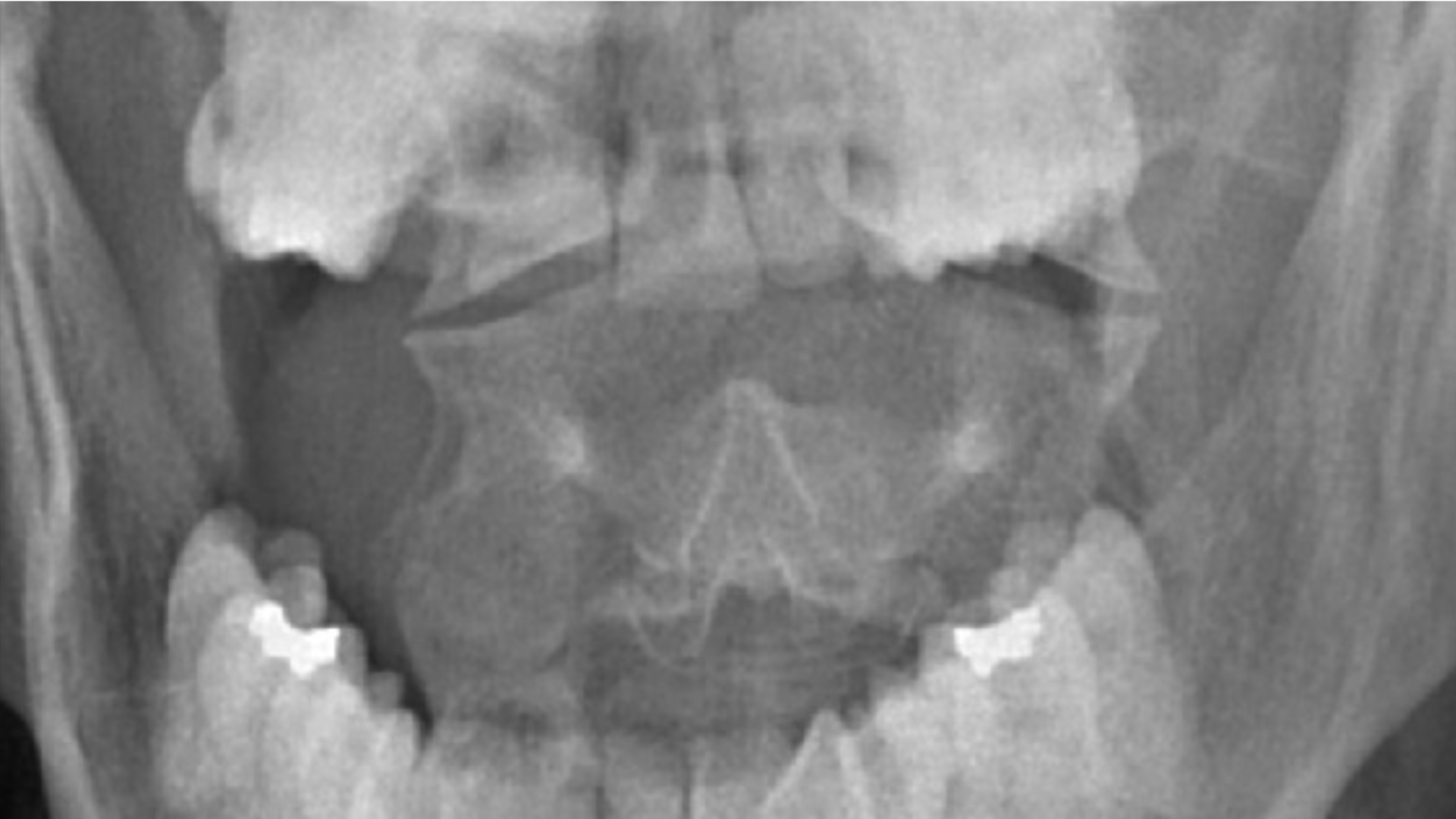 CCJ diagnostic imaging evaluation